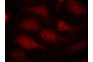 Immunofluorescence staining of methanol-fixed Hela cells using CDK6(phospho-Tyr24) Antibody.