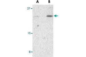 Western blot analysis of BIK in Jurkat cell lysate with BIK polyclonal antibody  at (A) 1 and (B) 2 ug/mL . (BIK anticorps  (N-Term))
