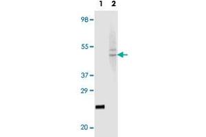 Western blot analysis using FBLN5 monoclonal antibody, clone 3F10A5, 3F8A12  against truncated recombinant FBLN5 (Lane 1) and HeLa cell lysate (Lane 2).