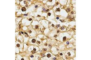 Immunohistochemistry (IHC) image for anti-Ribosomal Protein S5 (RPS5) antibody (ABIN7308294)