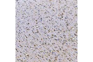 IHC analysis of TOM1L1 using anti-TOM1L1 antibody (ABIN7602631). (TOM1L1 anticorps  (AA 9-448))