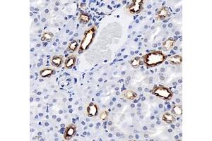 Immunohistochemistry of paraffin embedded rat kidney using MAL2 (ABIN7074549) at dilution of 1: 700 (400x lens)