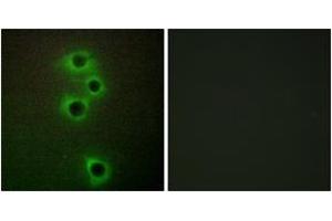 Immunofluorescence analysis of A549 cells, using MARK4 Antibody. (MARK4 anticorps  (AA 461-510))