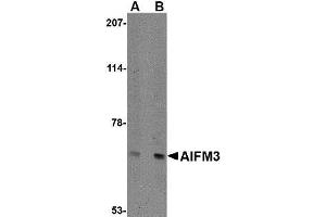 Western blot analysis of NIPSNAP in human brain tissue lysate with AP30032PU-N NIPSNAP antibody at (A) 0. (AIFM3 anticorps  (N-Term))