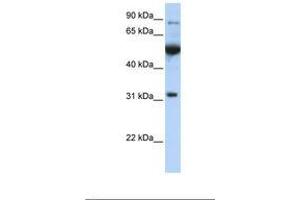 Image no. 1 for anti-Eukaryotic Translation Initiation Factor 2B, Subunit 1 Alpha, 26kDa (EIF2B1) (C-Term) antibody (ABIN6738798)