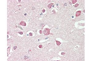 Anti-PDE2 / PDE2A antibody IHC staining of human brain, cortex.