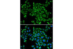 Immunofluorescence analysis of U2OS cells using PRKCA antibody. (PKC alpha anticorps)