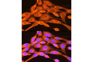Immunofluorescence analysis of NIH-3T3 cells using PHKG2 Rabbit pAb  at dilution of 1:100 (40x lens).