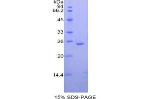 SDS-PAGE analysis of IL27 Protein. (IL-27 Protéine)