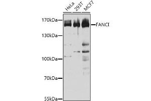 Western blot analysis of extracts of various cell lines, using FANCI antibody (ABIN1679817, ABIN3017801, ABIN3017802 and ABIN6220261) at 1:1000 dilution. (FANCI anticorps  (AA 1061-1328))