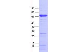 Validation with Western Blot