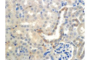 Immunohistochemistry analysis using Mouse Anti-ENaC beta Monoclonal Antibody, Clone 7B8 .