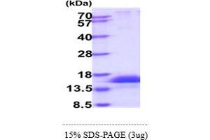 SDS-PAGE (SDS) image for CD247 Molecule (CD247) (AA 52-164) protein (His tag) (ABIN6388181)
