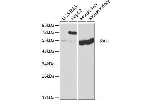 Western blot analysis of extracts of various cell lines using PAH Polyclonal Antibody at dilution of 1:1000.