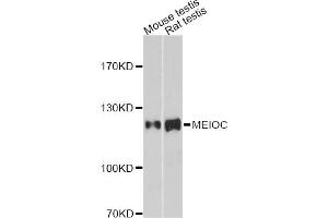 Western blot analysis of extracts of various cell lines, using MEIOC antibody. (Gm1564 anticorps)