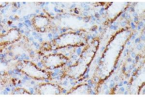 Immunohistochemistry of paraffin-embedded Rat kidney using IDH3A Polyclonal Antibody at dilution of 1:100 (40x lens). (IDH3A anticorps)