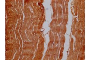 anti-Oral-Facial-Digital Syndrome 1 (OFD1) (AA 598-771) antibody