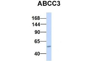 Host:  Rabbit  Target Name:  CHAD  Sample Type:  Human Adult Placenta  Antibody Dilution:  1. (ABCC3 anticorps  (Middle Region))