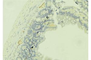 ABIN6279350 at 1/100 staining Mouse colon tissue by IHC-P.
