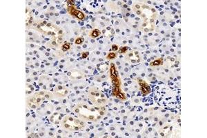Immunohistochemistry analysis of paraffin-embedded mouse kidney using,SLC12A1 (ABIN7075651) at dilution of 1: 2000