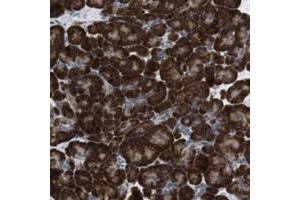 Immunohistochemical staining of human pancreas with UGCGL1 polyclonal antibody  shows strong cytoplasmic positivity in exocrine glandular cells.