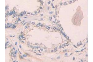 Used in DAB staining on fromalin fixed paraffin- embedded rectum cancer tissue (IL1R1 anticorps  (AA 226-318))