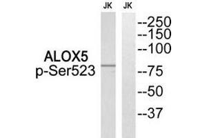 Western blot analysis of extracts from Jurkat cells, using ALOX5 (Phospho-Ser523) antibody. (ALOX5 anticorps  (pSer523))