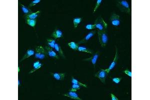 IF analysis of ANGPT2 using anti-ANGPT2 antibody (ABIN7601450). (Angiopoietin 2 anticorps  (AA 357-404))