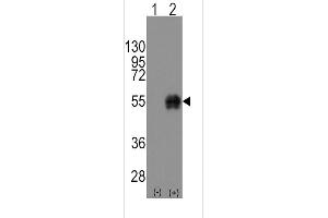 Western blot analysis of CD14 using rabbit polyclonal CD14 Antibody using 293 cell lysates (2 ug/lane) either nontransfected (Lane 1) or transiently transfected with the CD14 gene (Lane 2). (CD14 anticorps  (C-Term))