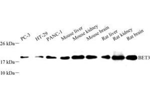 Western blot analysis of BET3 (ABIN7075949) at dilution of 1: 500 (TRAPPC3 anticorps)