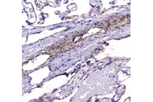 IHC analysis of PDE4D using anti-PDE4D antibody .