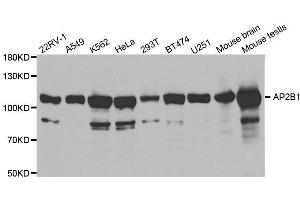 Western blot analysis of extracts of various cell lines, using AP2B1 antibody. (AP2B1 anticorps  (AA 752-951))