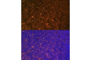 anti-Connective Tissue Growth Factor (CTGF) (AA 27-349) antibody