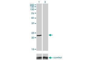Western blot analysis of FXN over-expressed 293 cell line, cotransfected with FXN Validated Chimera RNAi (Lane 2) or non-transfected control (Lane 1). (Frataxin anticorps  (AA 91-200))