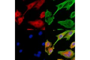 ABIN6264582 and ABIN6279743 staining HepG2 cells by IF/ICC. (RAB40C anticorps  (C-Term))