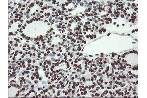 Image no. 17 for anti-Non-POU Domain Containing, Octamer-Binding (NONO) (AA 184-385) antibody (ABIN1491073) (NONO anticorps  (AA 184-385))