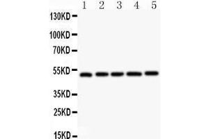 Anti- NR1H3 antibody,  Western blotting All lanes: Anti NR1H3 () at 0. (NR1H3 anticorps  (C-Term))