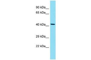 Western Blotting (WB) image for anti-Suppressor of Defective Silencing 3 Homolog (SUDS3) (N-Term) antibody (ABIN2788991)
