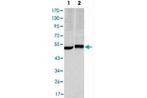 Western blot analysis using CA9 monoclonal antibody, clone 2D3  against HeLa (1) and A-549 (2) cell lysate. (CA9 anticorps)