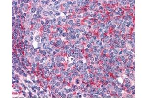 IHC testing of FFPE human tonsil tissue with Thyroid hormone receptor alpha antibody at 3.
