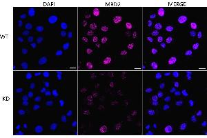 Immunocytochemical staining of HT- cells using MBD2 antibody (ABIN7799387), 1:1,000), Top panel: wild-type (WT), Bottom panal: MBD2 shRNA knockdown (KD). (Recombinant MBD2 anticorps)