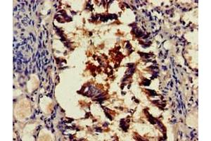 Immunohistochemistry of paraffin-embedded human lung tissue using ABIN7168699 at dilution of 1:100 (SCTR anticorps  (AA 51-135))