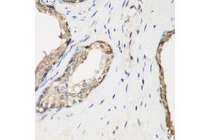 Immunohistochemistry of paraffin-embedded human prostate using METTL7A antibody.