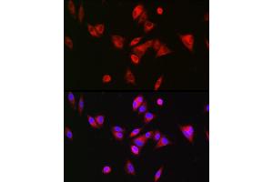 Immunofluorescence analysis of Hep G2 cells using BAAT Rabbit pAb (ABIN6131367, ABIN6137411, ABIN6137412 and ABIN6223563) at dilution of 1:200 (40x lens). (BAAT anticorps  (AA 309-418))