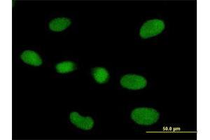Immunofluorescence of purified MaxPab antibody to RPP40 on HeLa cell. (RPP40 anticorps  (AA 1-244))