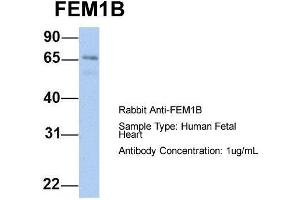 Host: Rabbit  Target Name: FEM1B  Sample Tissue: Human Fetal Heart  Antibody Dilution: 1. (FEM1B anticorps  (C-Term))