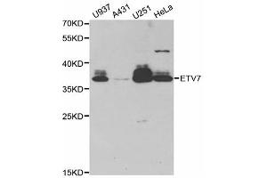 Western blot analysis of extracts of various cell lines, using ETV7 antibody (ABIN5973686) at 1/1000 dilution. (ETV7 anticorps)