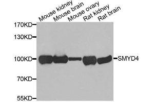 Western blot analysis of extracts of various cell lines, using SMYD4 antibody. (SMYD4 anticorps  (AA 1-260))
