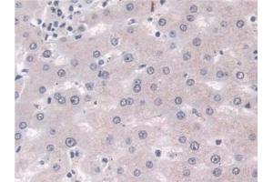Detection of PLD in Human Liver Tissue using Polyclonal Antibody to Phospholipase D (PLD) (Phospholipase D anticorps  (AA 725-1074))