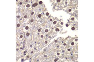 Immunohistochemistry of paraffin-embedded mouse liver using ST14 antibody (ABIN6293606) at dilution of 1:200 (40x lens). (ST14 anticorps)